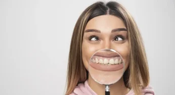 Gummy Smile: Ketika Gusi Terlihat Saat Tersenyum