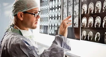 Mencegah Stroke: Tips Menjaga Kesehatan Pembuluh Darah