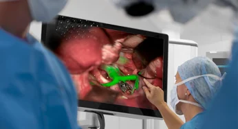 Penyakit Moyamoya: Penyebab Stroke Langka di Usia Muda