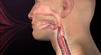 Epiglotitis: Peradangan Serius yang Bisa Mengancam Nyawa