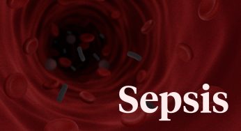 Waspadai Kondisi Sepsis! Ancaman Nyata bagi Kesehatan