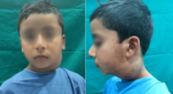 Dari Mulut ke Darah: Risiko Sepsis Akibat Abses Submandibula