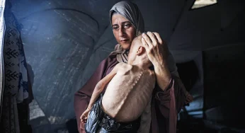 Krisis Gizi Parah di Gaza, WHO Minta Bantuan Dikirim Tanpa Halangan