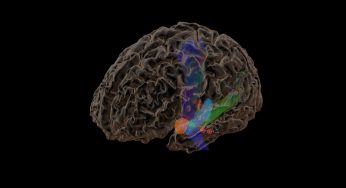 Epilepsi: Mengenal Penyakit Kejang yang Penuh Stigma