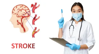 Peringatan Dini: Risiko Stroke Dini Terkait Golongan Darah Ini