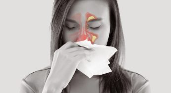 Apakah Infeksi Gigi Bisa Menyebabkan Sinusitis? Ini Penjelasan Dokter Yurika
